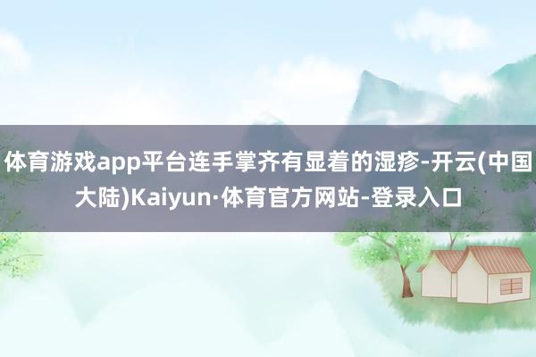 体育游戏app平台连手掌齐有显着的湿疹-开云(中国大陆)Kaiyun·体育官方网站-登录入口